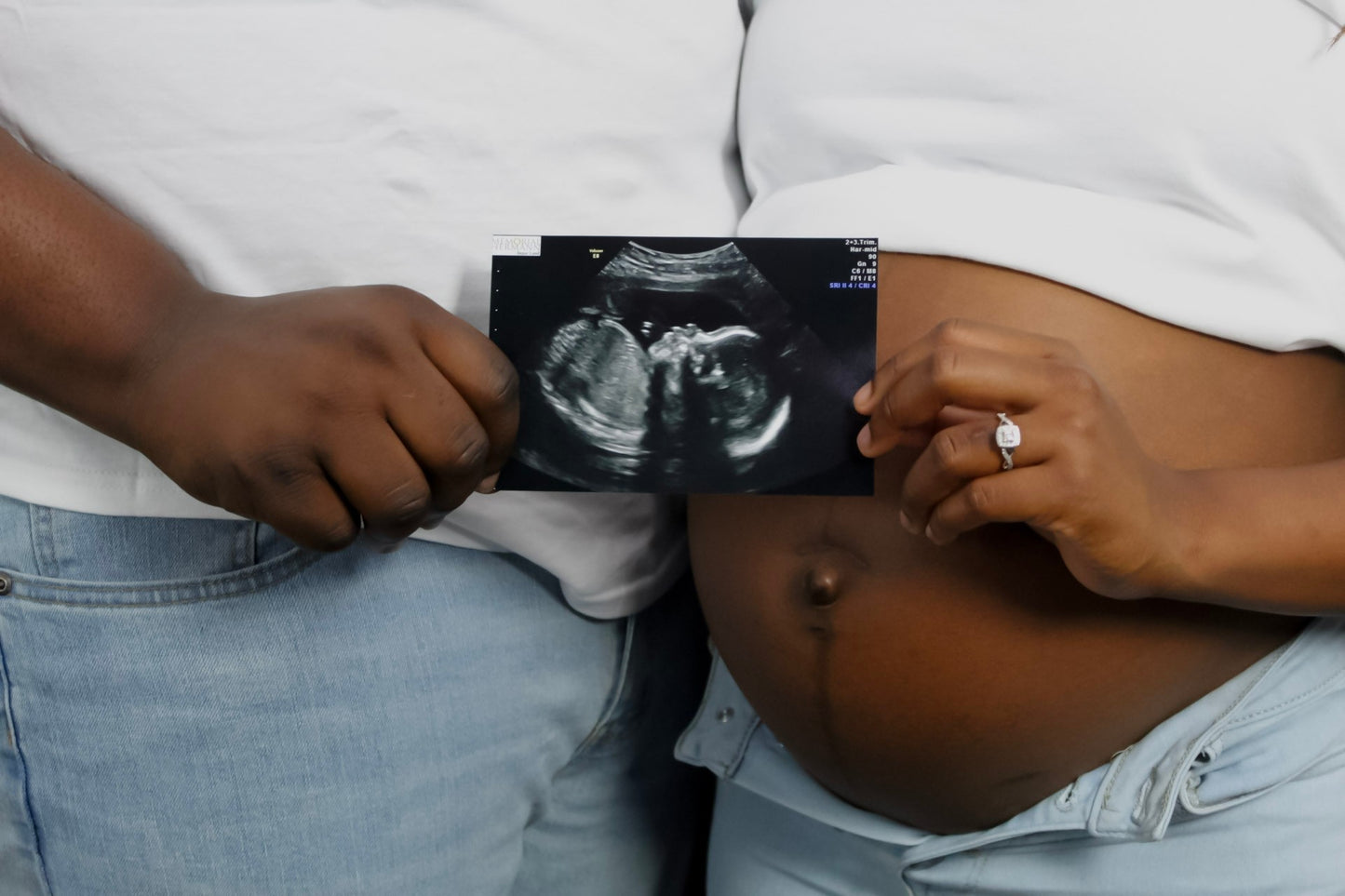 Maternity Couple 60 minutes (Studio)